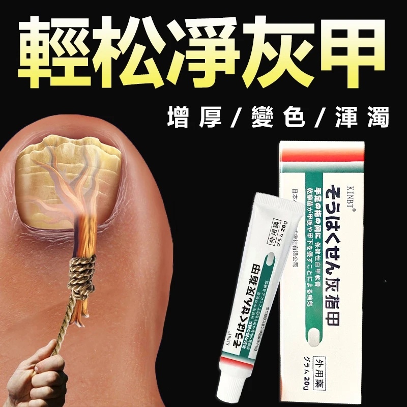 灰指甲的救星，🔥🔥灰甲抑菌膏！恢復指甲健康，有效解決灰指甲、甲溝炎問題，讓指甲7天重獲新生，就是這麼簡單。
