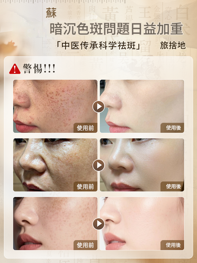 美白祛斑乳霜提亮去黃改善暗沉保濕補水淡祛色斑黃褐斑雀斑菸鹼醯胺 美白祛斑乳霜提亮去黃改善暗沉保濕補水淡祛色斑黃褐斑雀斑菸鹼醯胺