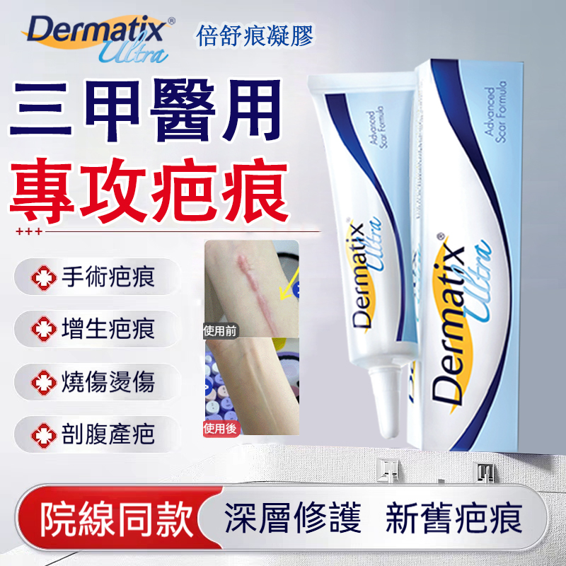 倍舒痕Dermatix祛疤膏手術增生疤痕修復醫用矽酮凝膠剖腹產 手術疤 增生疤 燙傷疤 倍舒痕Dermatix祛疤膏手術增生疤痕修復醫用矽酮凝膠剖腹產 手術疤 增生疤 燙傷疤