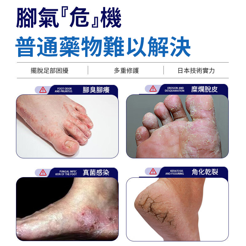 【食藥署認證 日本爽腳噴劑】✨ 台大皮膚部主治醫師烏惟新推薦🦶,針對角化型香港腳設計,噴劑殺菌止癢💥,改善腳癬、脫皮、裂縫、腳臭、水泡與異味|二重ケア🇯🇵 深層滲透厚角質,修護乾裂脫屑👌 【食藥署認證 日本爽腳噴劑】✨ 台大皮膚部主治醫師烏惟新推薦🦶,針對角化型香港腳設計,噴劑殺菌止癢💥,改善腳癬、脫皮、裂縫、腳臭、水泡與異味|二重ケア🇯🇵 深層滲透厚角質,修護乾裂脫屑👌