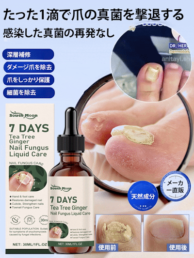 【食藥署認證 日本專業亮甲噴劑】✨日本醫師專業推薦 💅針對灰指甲(甲癬)與指甲增厚設計。噴劑能有效殺菌、從根源修護 💥徹底改善指甲變色、變脆、增厚、甲床分離與指甲異味|二重ケア🇯🇵 深層滲透頑固甲板,喚醒指甲健康光澤 👌 【食藥署認證 日本專業亮甲噴劑】✨日本醫師專業推薦 💅針對灰指甲(甲癬)與指甲增厚設計。噴劑能有效殺菌、從根源修護 💥徹底改善指甲變色、變脆、增厚、甲床分離與指甲異味|二重ケア🇯🇵 深層滲透頑固甲板,喚醒指甲健康光澤 👌